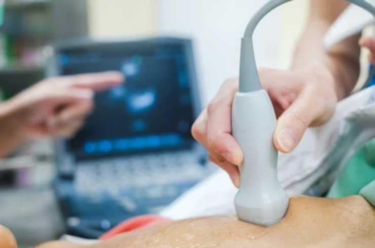 D Echocardiography--------18,RYAN Scan Diagnostic & Clinic, Dr. Praveena Goura