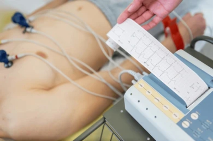 ECG (Electrocardiogram)--------18,RYAN Scan Diagnostic & Clinic, Dr. Praveena Goura
