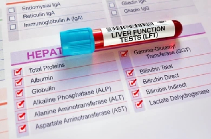 Liver Function Tests,RYAN Scan Diagnostic & Clinic, Dr. Praveena Goura