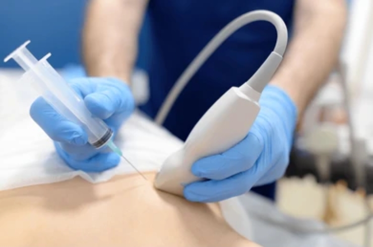 USG-Guided Biopsies-------------18,RYAN Scan Diagnostic & Clinic, Dr. Praveena Goura