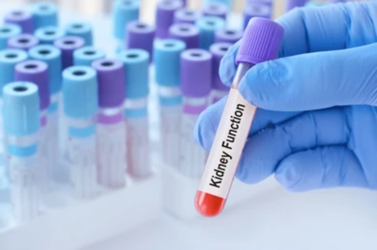 Kidney Function Tests