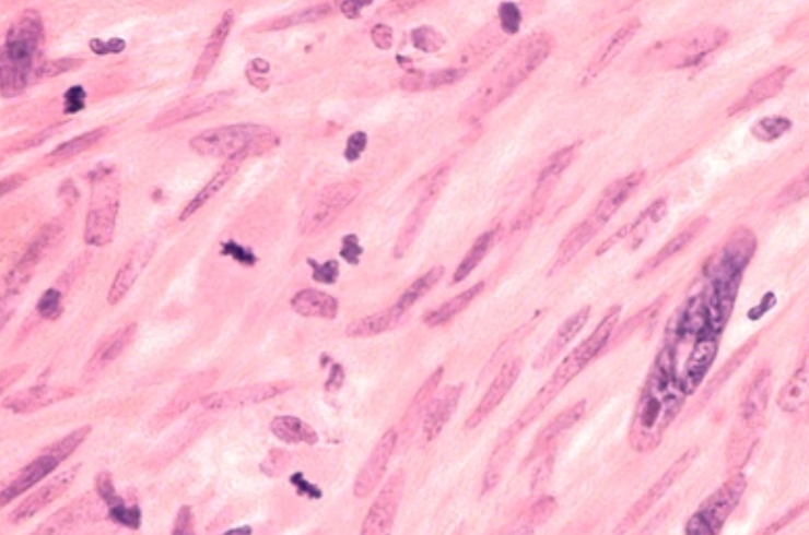 Soft Tissue and Small Part Scans